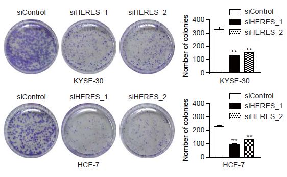 데일리포스트 / 사진설명 =  KYSE-30, HCE-7 두 암세포 군락에 HERES를 억제한 결과 암세포 군락이 현저히 줄어 HERES가 암세포 증식에 관여한다는 사실을 확인했다.