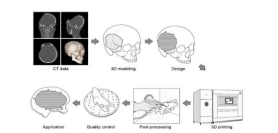 의료 3D 프린팅 기본 개념도 ⓒ 데일리포스트 이미지  출처=과기정통부 제공