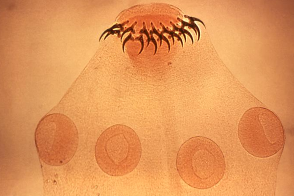 유구조충 ⓒ데일리포스트=이미지 제공/Wikipedia 