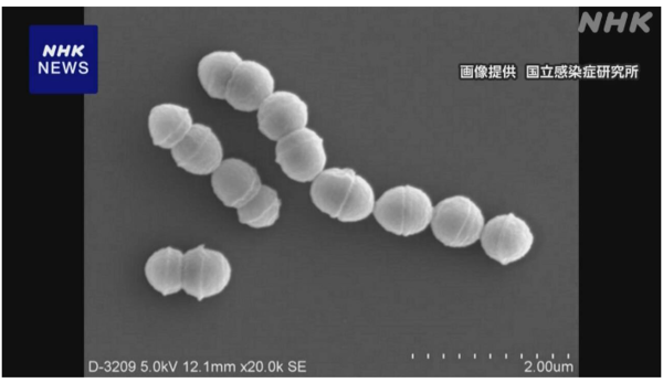 ⓒ데일리포스트=이미지 제공/NHK 