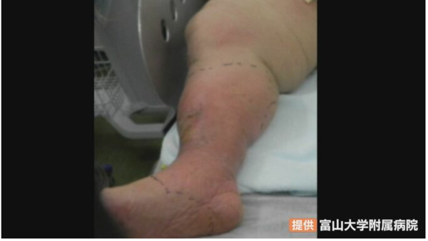 ⓒ데일리포스트=이미지 제공/후쿠야마대학부속병원