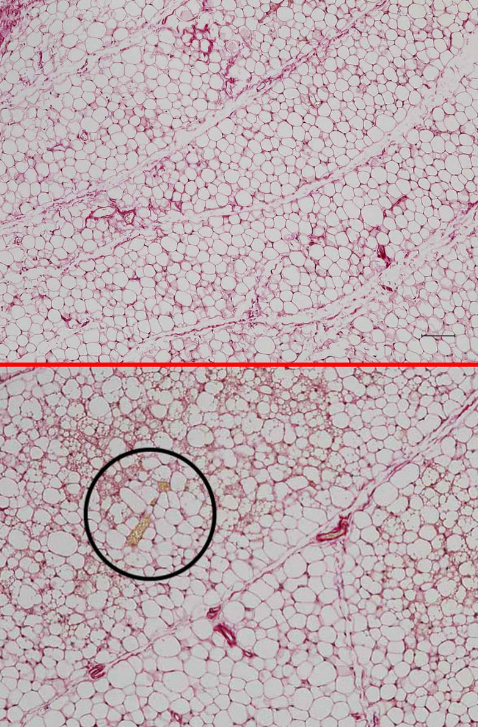 ⓒ데일리포스트=이미지 제공/Journal of Clinical Investigation