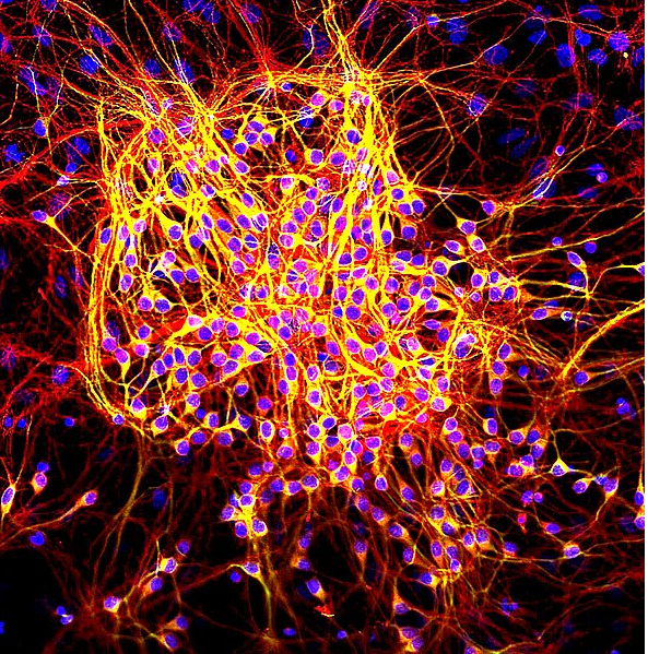 ⓒ데일리포스트=이미지 출처/Wikipedia
