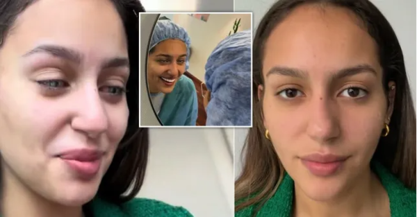 갈색 눈동자를 푸른색으로 바꾼 '각막 색소 침착술' 사례 ⓒ데일리포스트=이미지 제공/new color flaak’ 인스타그램 