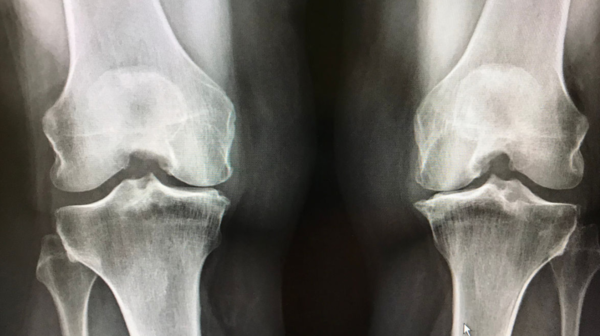 ⓒ데일리포스트=이미지 제공/PxHere