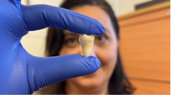 킹스칼리지런던 연구진이 실험실에서 배양된 치아 조직을 들고 있는 모습. 환자 자신의 세포로 배양한 '진짜 이'의 가능성을 보여준다.  ⓒ데일리포스트=이미지 제공/King’s College London