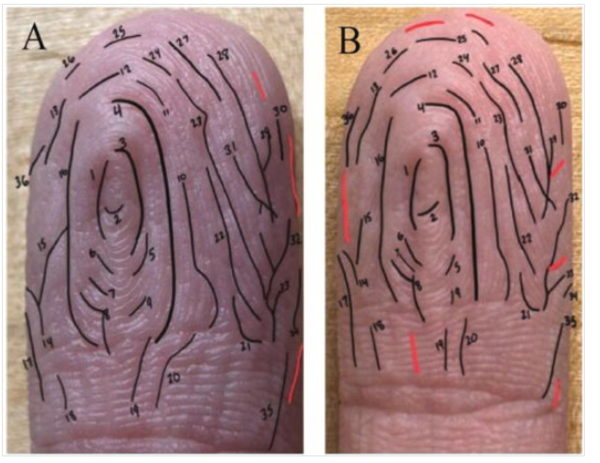ⓒ데일리포스트=이미지 제공/Journal of the Mechanical behavior of Biomedical Materials