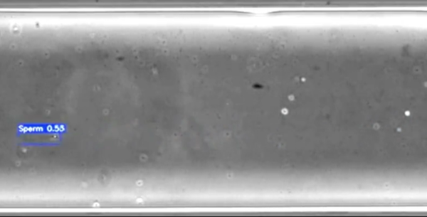 ⓒ데일리포스트=이미지 제공/Columbia University Fertility Center