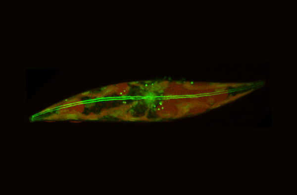 북극 규조류의 모습. 세포 중앙을 따라 흐르는 아크틴(actin) 섬유가 ‘빙판 위 스케이트’처럼 미끄러지는 이동을 가능하게 한다. ⓒ데일리포스트=이미지 제공/Prakash Lab
