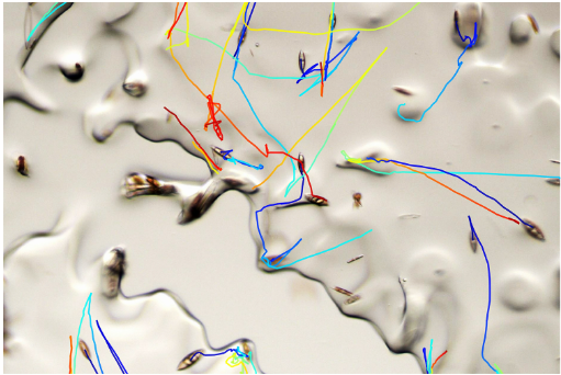 연구팀은 규조류가 얼음 속을 이동하는 모습을 추적하기 위해 특수 현미경과 실험 환경을 개발·활용했다.  ⓒ데일리포스트=이미지 제공/Prakash Lab